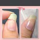 NailEase - Instant Repair Gel für stärkere und glänzende Nägel mit schneller Trocknung und lang anhaltendem Glanz | 1+1 Frei